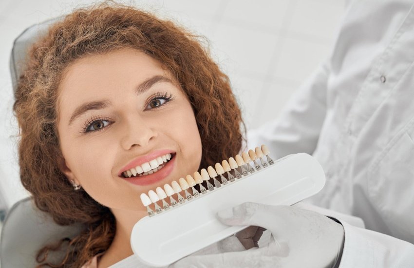 veneers