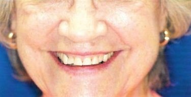 before patient photo