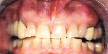 before patient photo