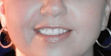 before patient photo