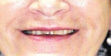 before patient photo