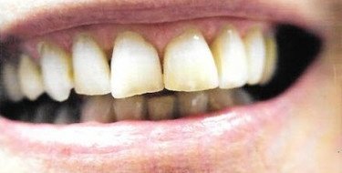 before patient photo