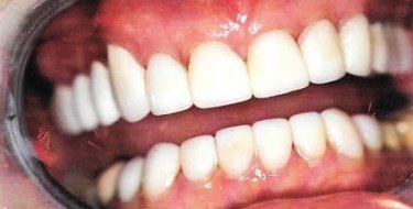 after patient photo